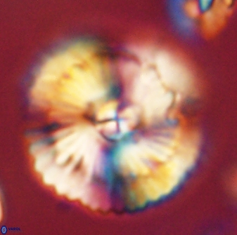 Heliolithus bukryi 62533