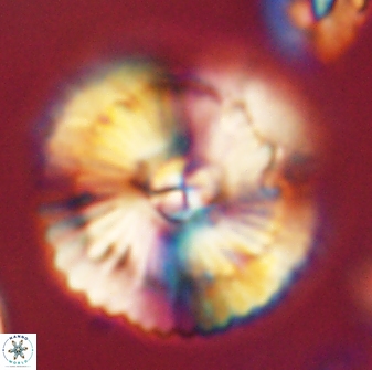 Heliolithus bukryi 62533