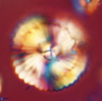 Heliolithus bukryi 62537