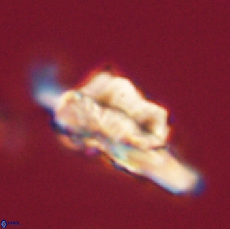 Heliolithus bukryi 62644