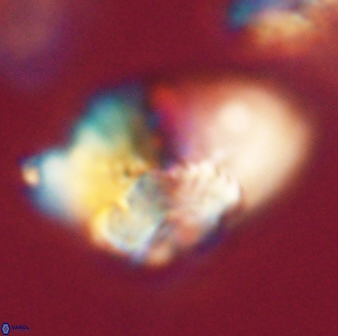 Heliolithus bukryi 62650