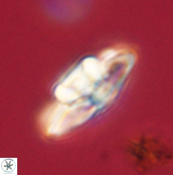 Heliolithus bukryi 62108