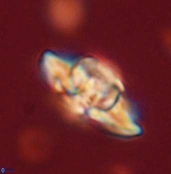 Heliolithus bukryi 62117