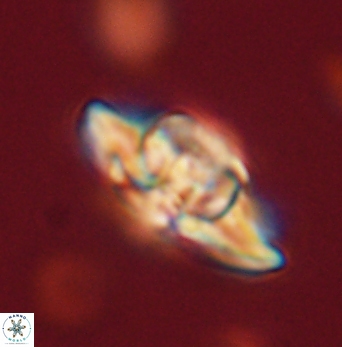 Heliolithus bukryi 62117