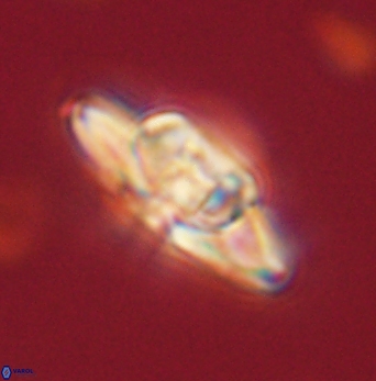 Heliolithus bukryi 62120