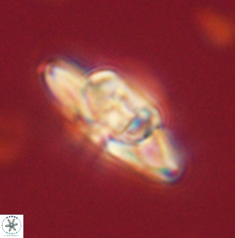 Heliolithus bukryi 62120