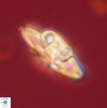 Heliolithus bukryi 62121