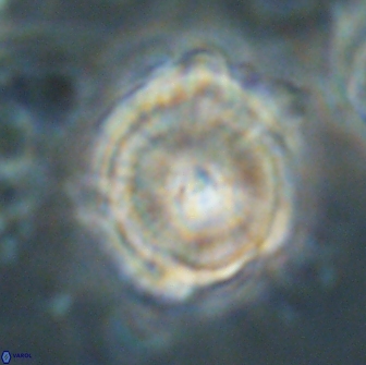Heliolithus bukryi 65910