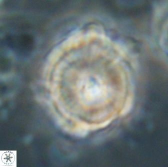 Heliolithus bukryi 65910