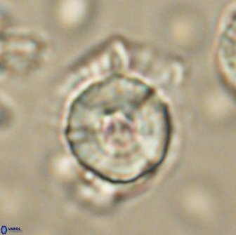 Heliolithus bukryi 65911