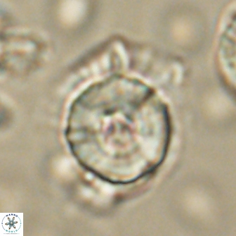 Heliolithus bukryi 65911