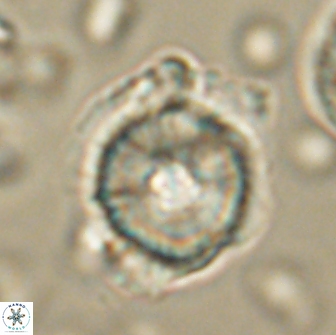 Heliolithus bukryi 65912
