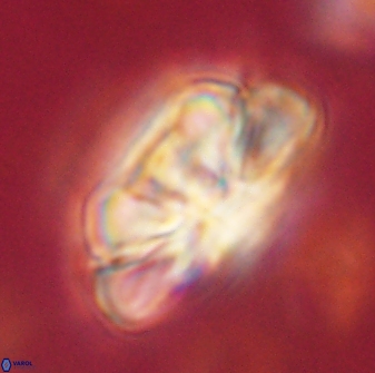 Heliolithus iptamenosdiskos 62501