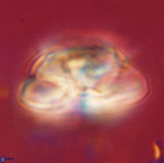 Heliolithus iptamenosdiskos 62504