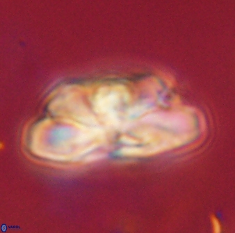 Heliolithus iptamenosdiskos 62505