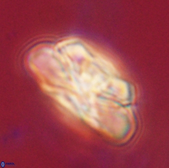 Heliolithus iptamenosdiskos 62512