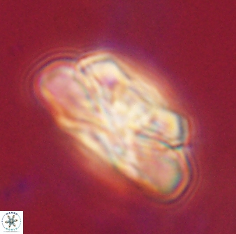 Heliolithus iptamenosdiskos 62512