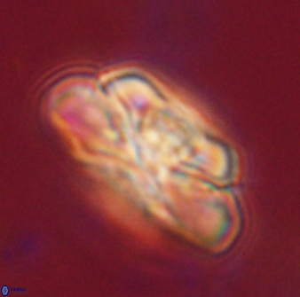 Heliolithus iptamenosdiskos 62513