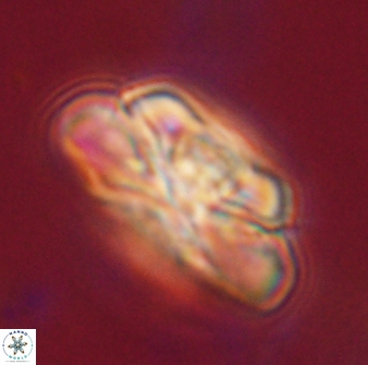 Heliolithus iptamenosdiskos 62513