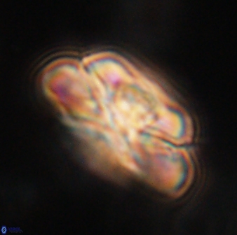 Heliolithus iptamenosdiskos 62514