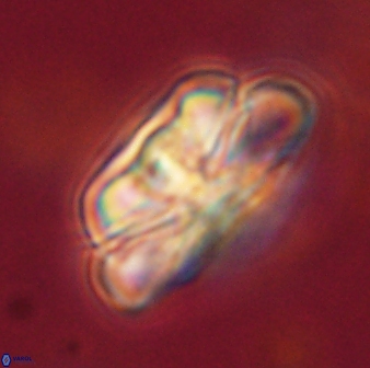 Heliolithus iptamenosdiskos 62517