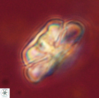 Heliolithus iptamenosdiskos 62517