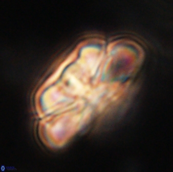 Heliolithus iptamenosdiskos 62518