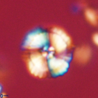 Heliolithus iptamenosdiskos 62574