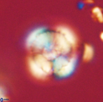 Heliolithus iptamenosdiskos 62575