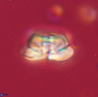 Heliolithus iptamenosdiskos 62578