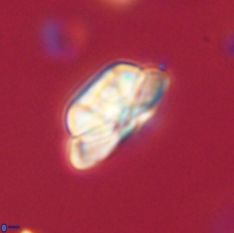 Heliolithus iptamenosdiskos 62579