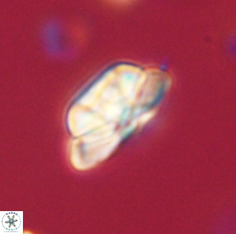 Heliolithus iptamenosdiskos 62579