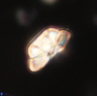 Heliolithus iptamenosdiskos 62580