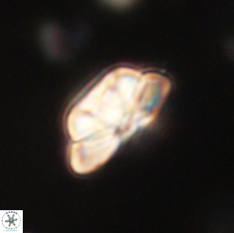 Heliolithus iptamenosdiskos 62580