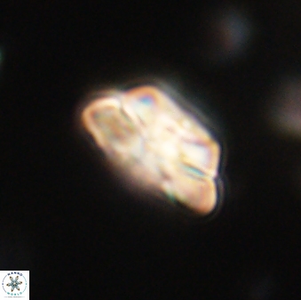 Heliolithus iptamenosdiskos 62581