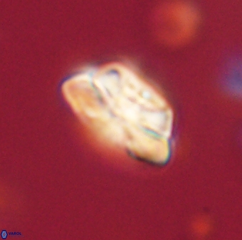 Heliolithus iptamenosdiskos 62582