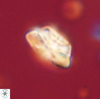 Heliolithus iptamenosdiskos 62582