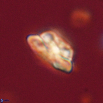 Heliolithus iptamenosdiskos 62583