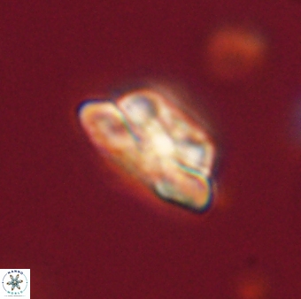 Heliolithus iptamenosdiskos 62583