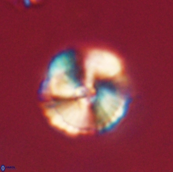 Heliolithus iptamenosdiskos 62586