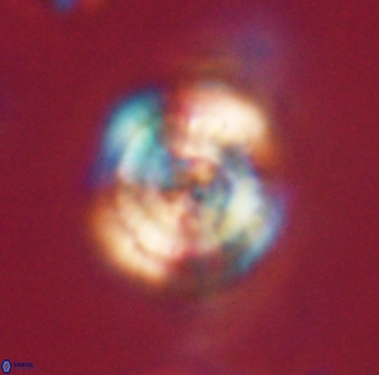 Heliolithus iptamenosdiskos 62587