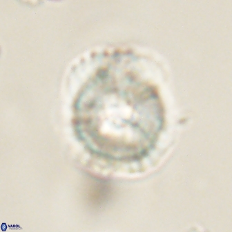 Heliolithus iptamenosdiskos 62591