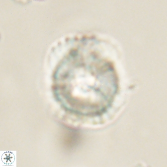 Heliolithus iptamenosdiskos 62591