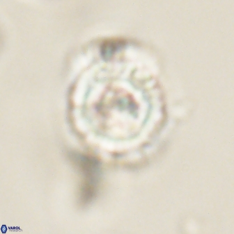 Heliolithus iptamenosdiskos 62592