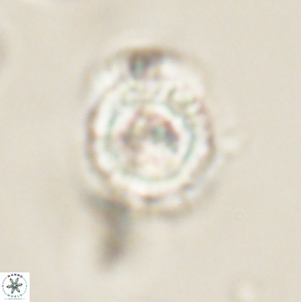 Heliolithus iptamenosdiskos 62592