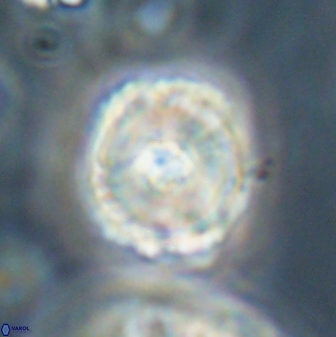 Heliolithus iptamenosdiskos 62595