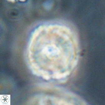 Heliolithus iptamenosdiskos 62595