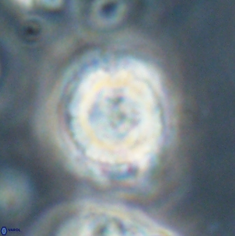 Heliolithus iptamenosdiskos 62596