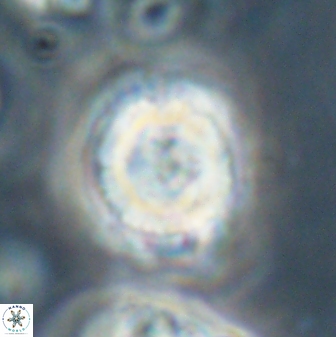 Heliolithus iptamenosdiskos 62596