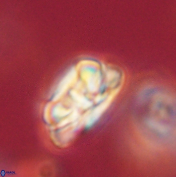 Heliolithus iptamenosdiskos 62265